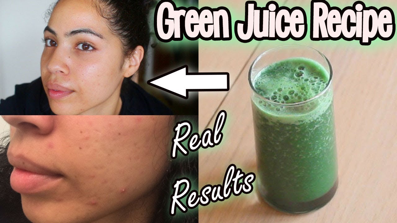 Celery Juice For Hormonal Acne: One Month Results