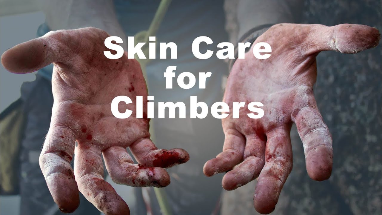 Skin Care - Prevention and Repair | Hand Care for Climbers Part 1