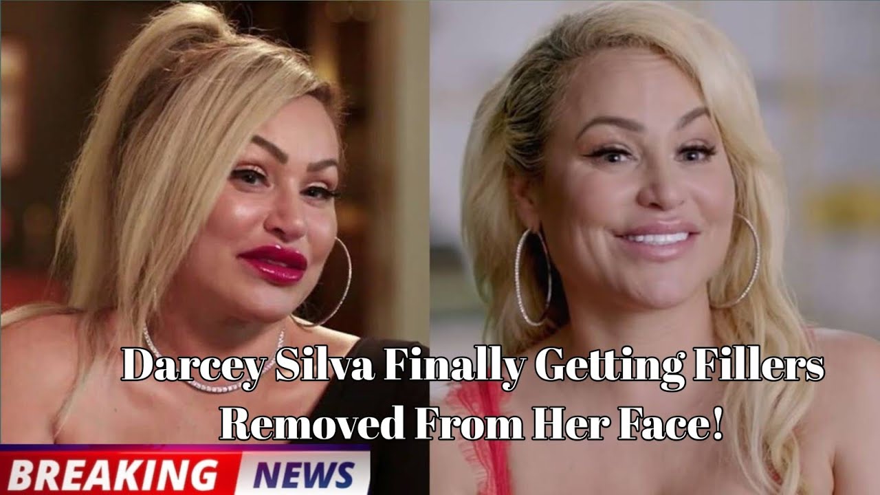 90 Day Fiance: Darcey Silva Finally Getting Fillers Removed From Her Face!