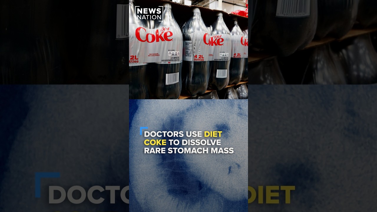 Doctors use Diet Coke to dissolve rare stomach mass | NewsNation