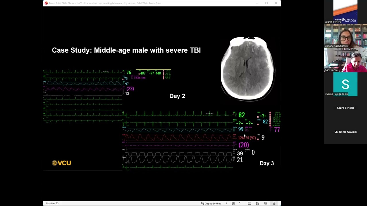 February 2026 Ultrasound Section - TCD Image Interpretation