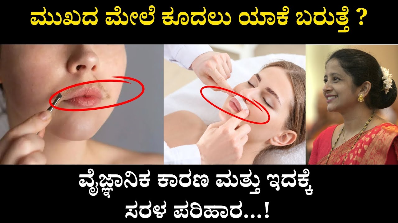 ಮುಖದ ಮೇಲೆ ಕೂದಲು ಯಾಕೆ ಬರುತ್ತೆ ? ವೈಜ್ಞಾನಿಕ ಕಾರಣ ಮತ್ತು ಇದಕ್ಕೆ ಸರಳ ಪರಿಹಾರ