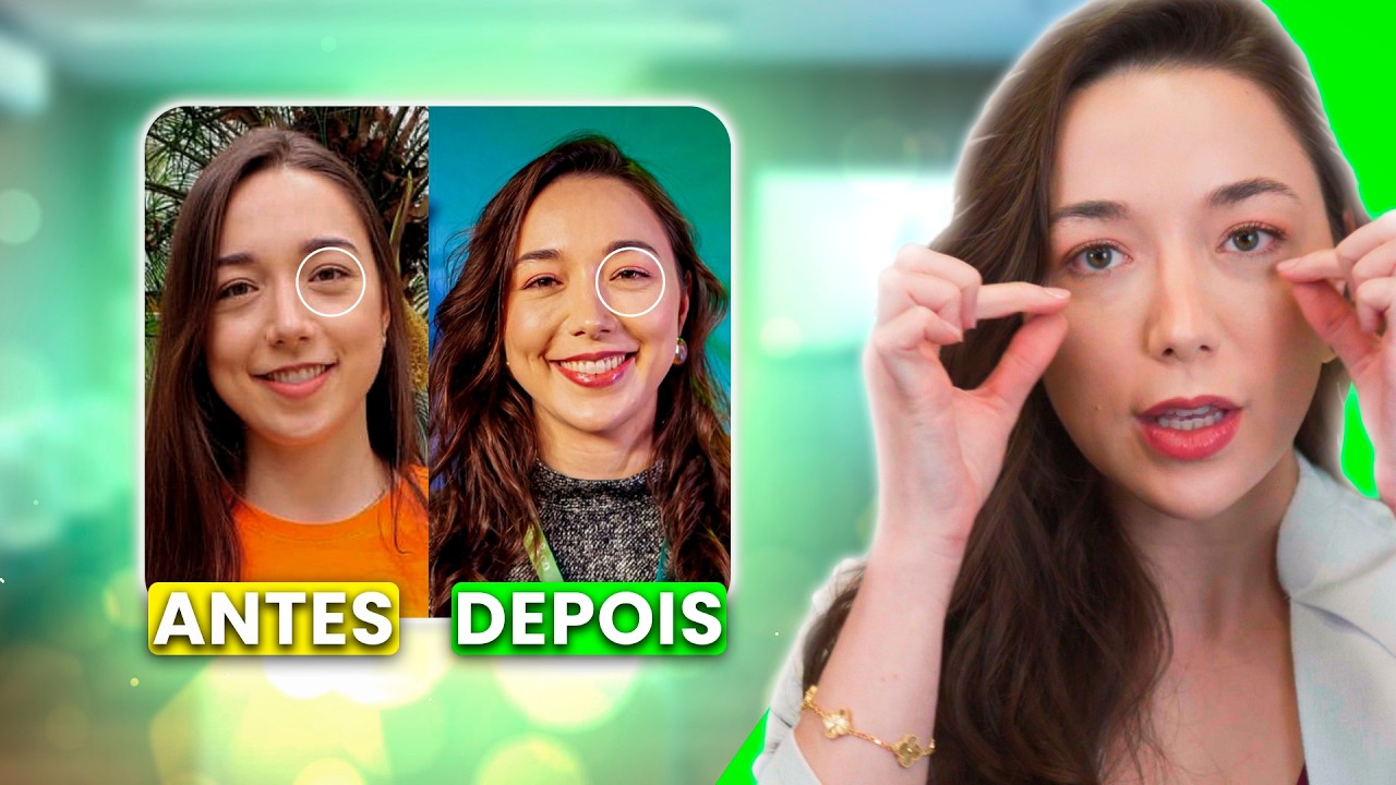 Como Acabar com as Bolsinhas nos Olhos? Tratamentos Eficazes e Naturais!