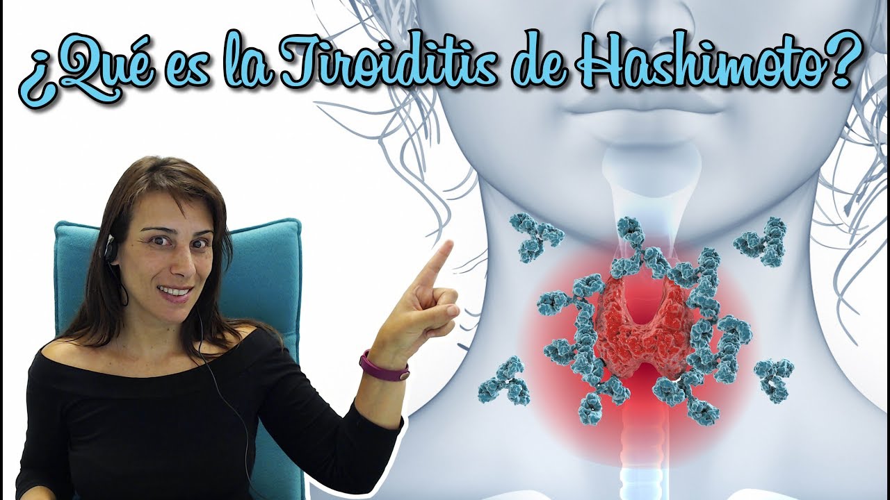 ¿Qué es la Tiroiditis de Hashimoto?