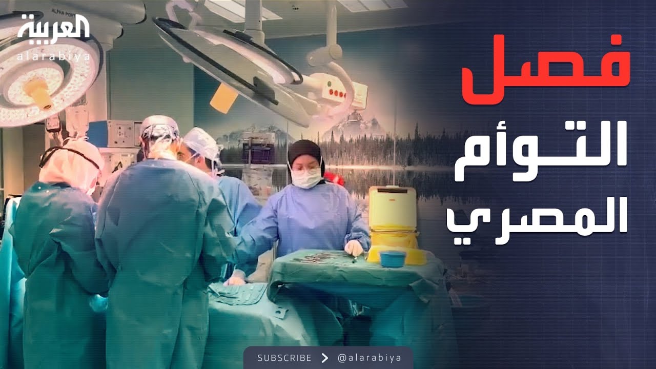 في وقت قياسي.. نجاح فصل توأم طفيلي مصري في السعودية