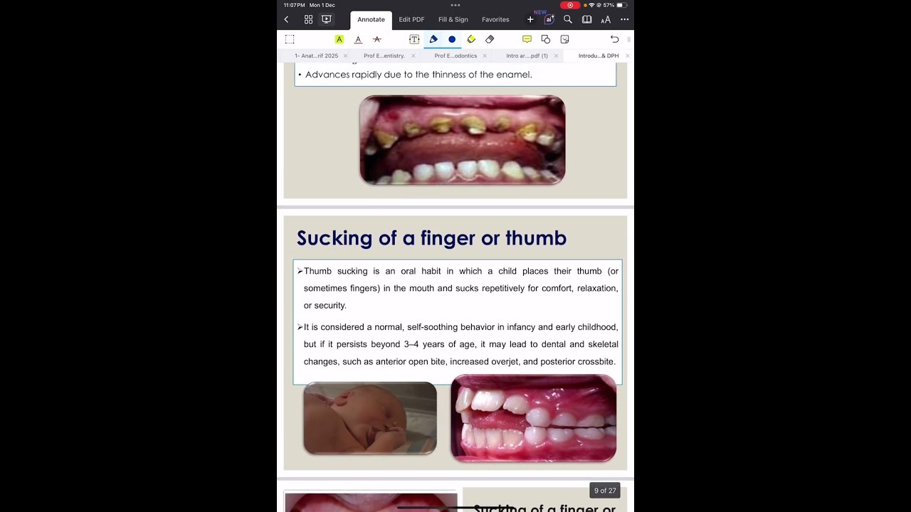 Intro lec 8 (1final ) lumina 🦷