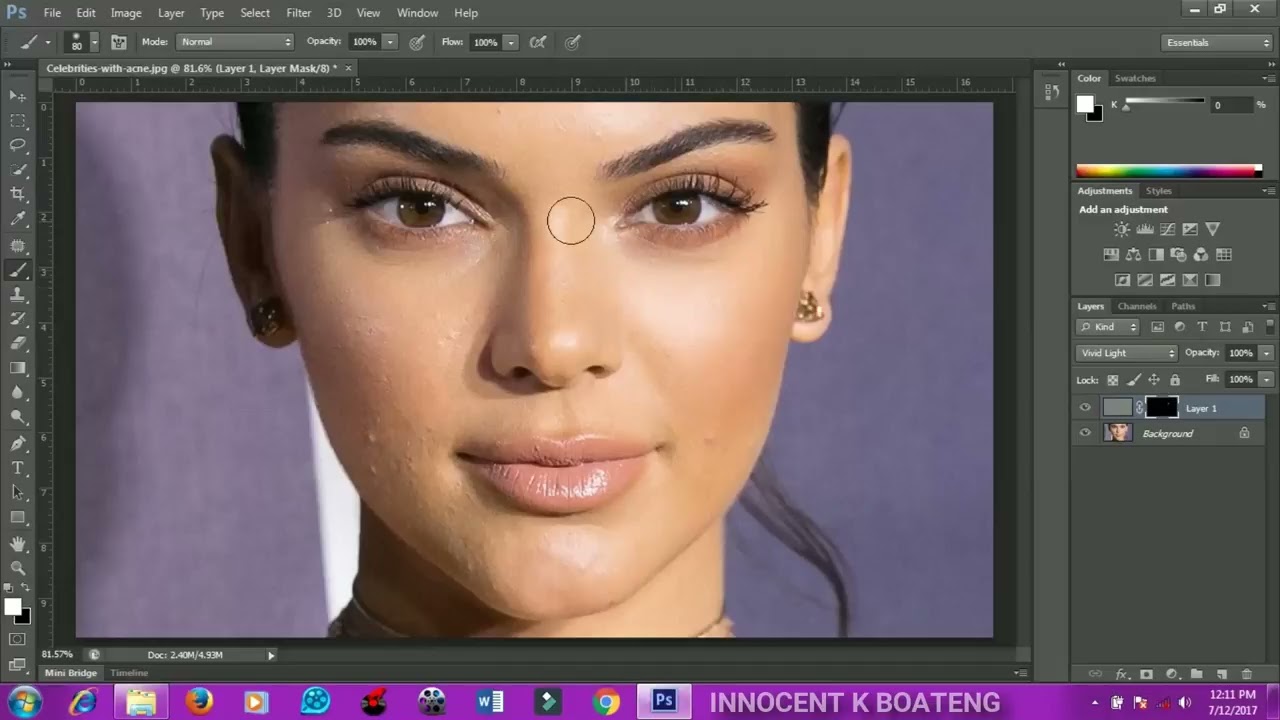 Photoshop Tutorial: Remove pimples and blemishes using photoshop
