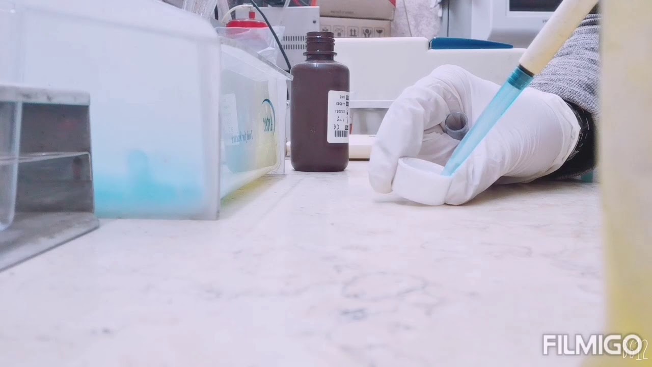 Glucose test. In blood                             الطريقة العملية لتحليل السكر  في المختبر وانواعه.