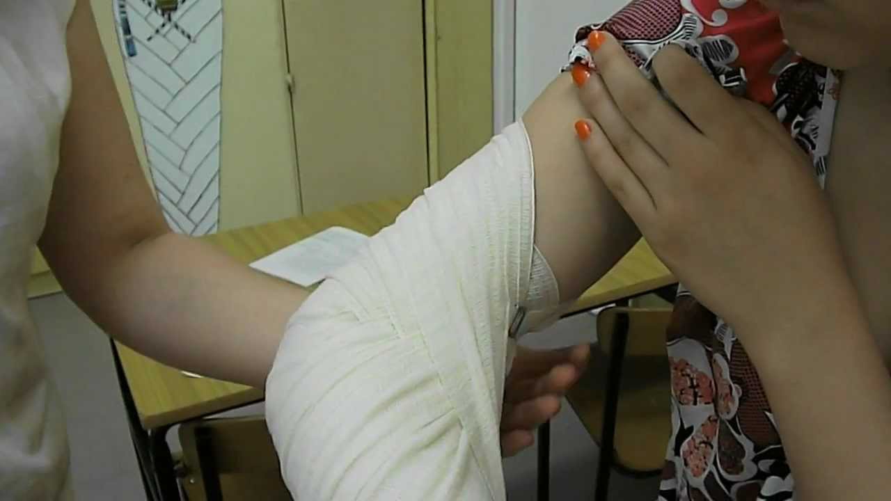 Opatrunek żółwiowy rozbieżny.