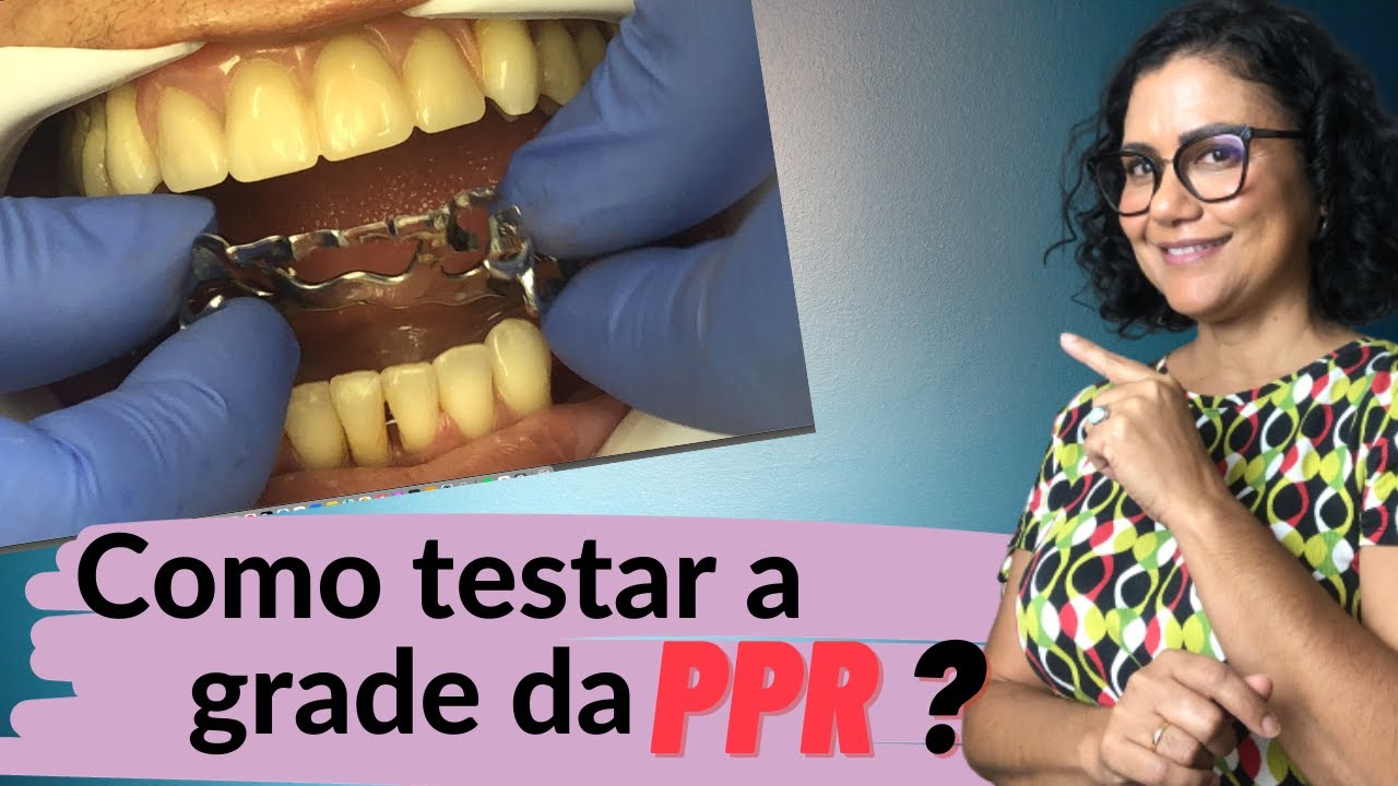 PASSO A PASSO DO TESTE DA GRADE DA PPR