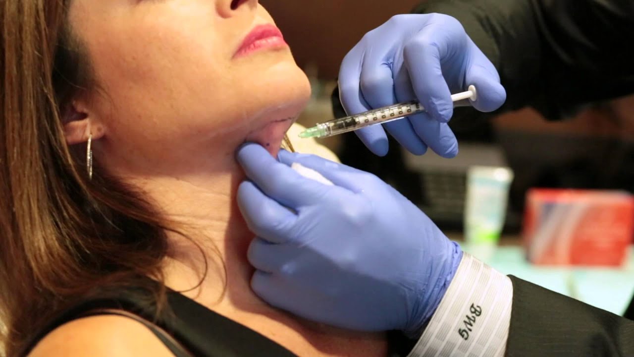 GAWLEY KYBELLA EVENT