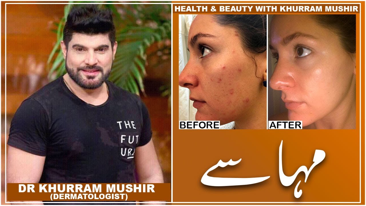 Acne Treatment, 100% Natural Home-made Remedies | Health & Beauty with Khurram Mushir