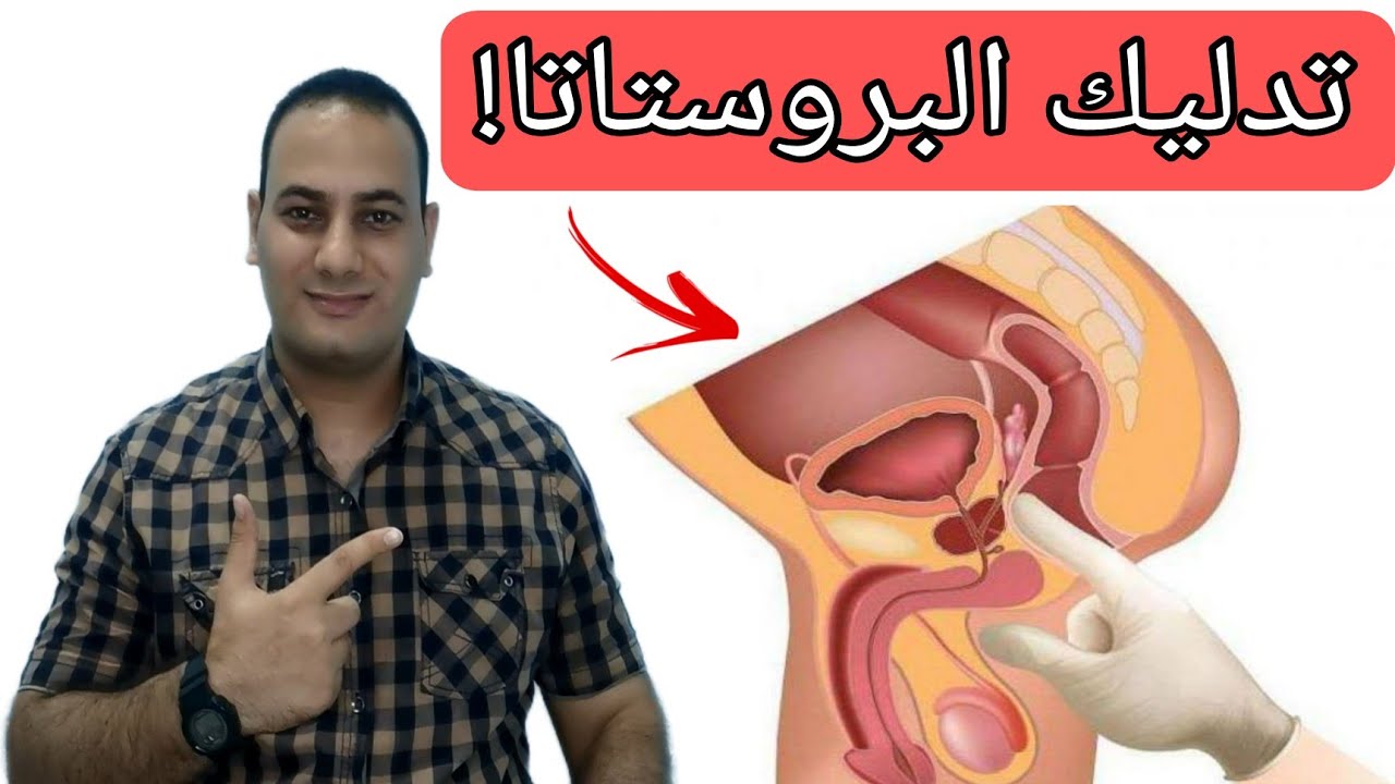 تحفيز البروستاتا | تدليك البروستاتا | وداعا ضعف الانتصاب وسرعه القذف | Prostate massage