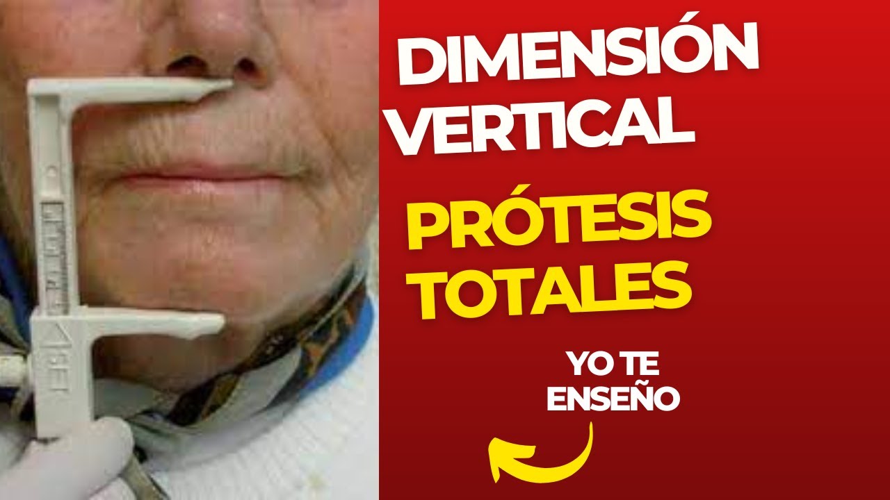 🤔❓Cómo se MIDE la DIMENSIÓN VERTICAL👅 en PRÓTESIS TOTALES
