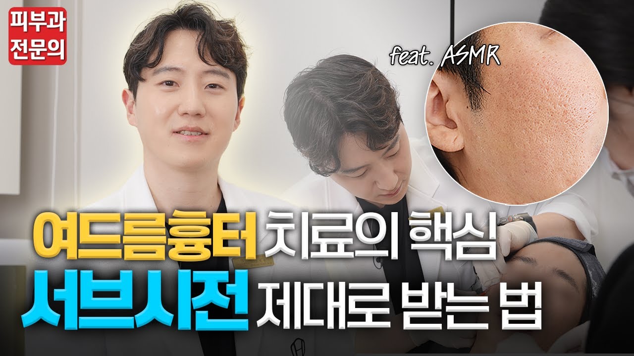 여드름 흉터 치료, 서브시전 시술 전부 보여드립니다!