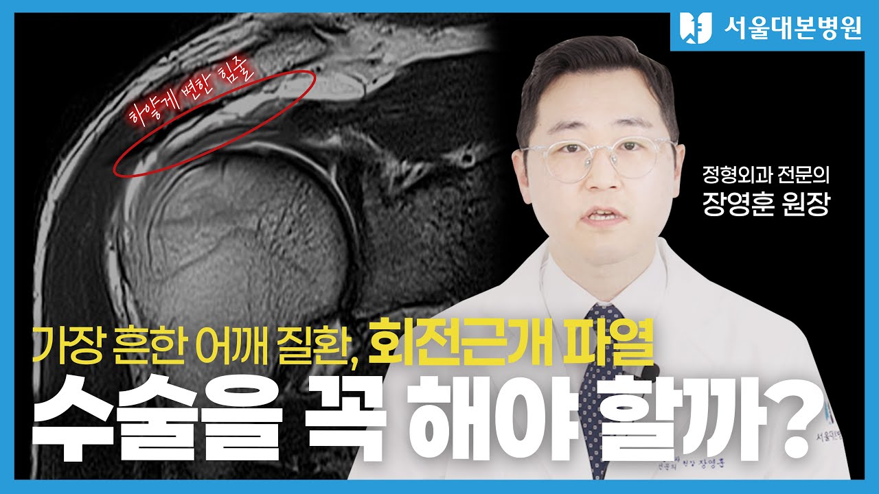회전근개 파열, 꼭 수술을 해야 할까?