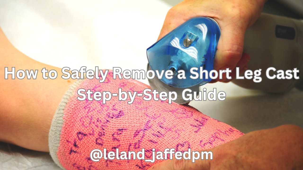 How to Safely Remove a Short Leg Cast | Step-by-Step Guide