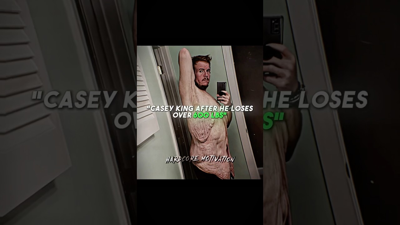 Incredible story of Casey King🫡 #caseyking #weightloss #motivation