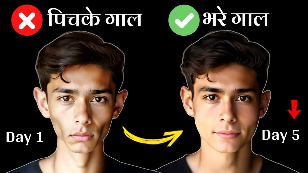 Pichke galo ko mota kaise kare | पिचके गाल कैसे फुलाए | Pichke gaal kaise fulaye