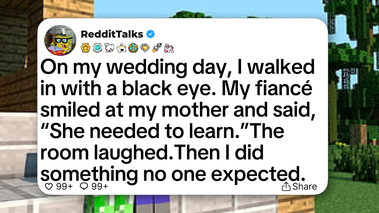 On my wedding day, I walked in with a black eye. My fiancé smiled at my mother and said...