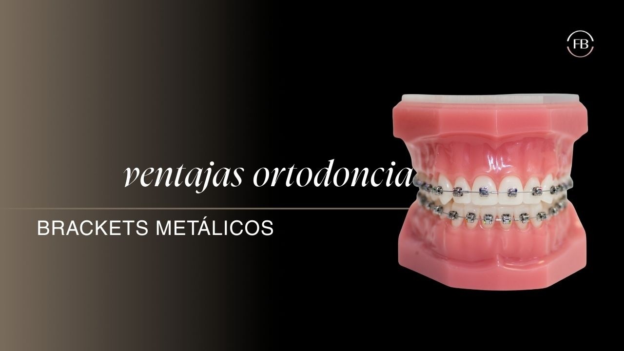 &iquest;Por qu&eacute; elegir un tratamiento de ortodoncia con brackets met&aacute;licos?  -  Cl&iacute;nica Ferrus & Bratos