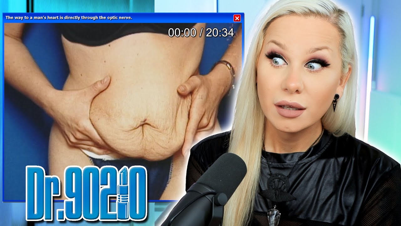 Is Tummy Tuck surgery worth it? (Dr 90210 reaction)