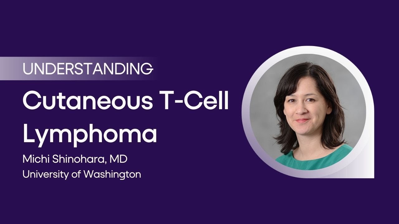 Newly Diagnosed Cutaneous T-Cell Lymphoma (CTCL)