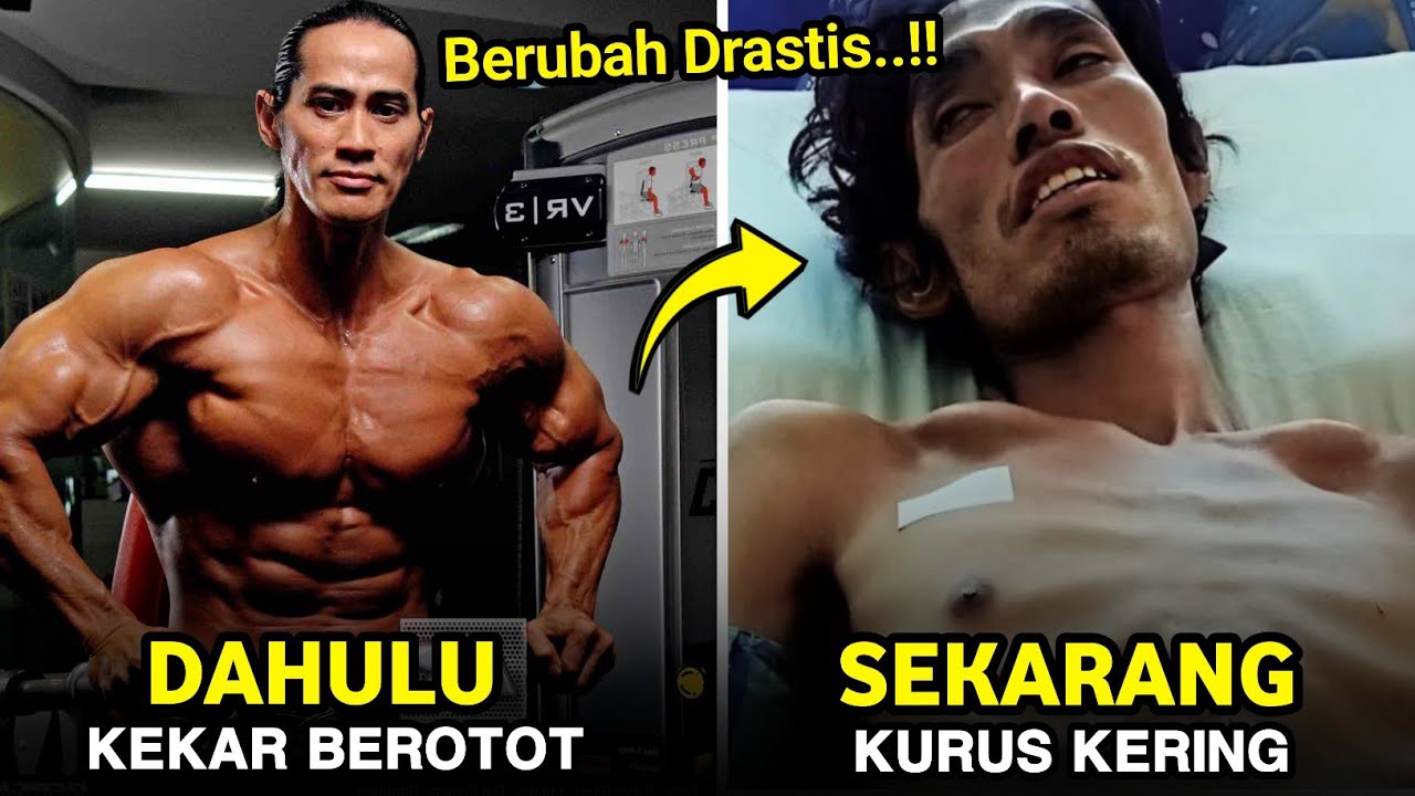 Tak Ada Yang Menyangka, 7 Artis Bertubuh Kekar Ini Alami Sakit Parah Hingga Tinggal Kulit & Tulang
