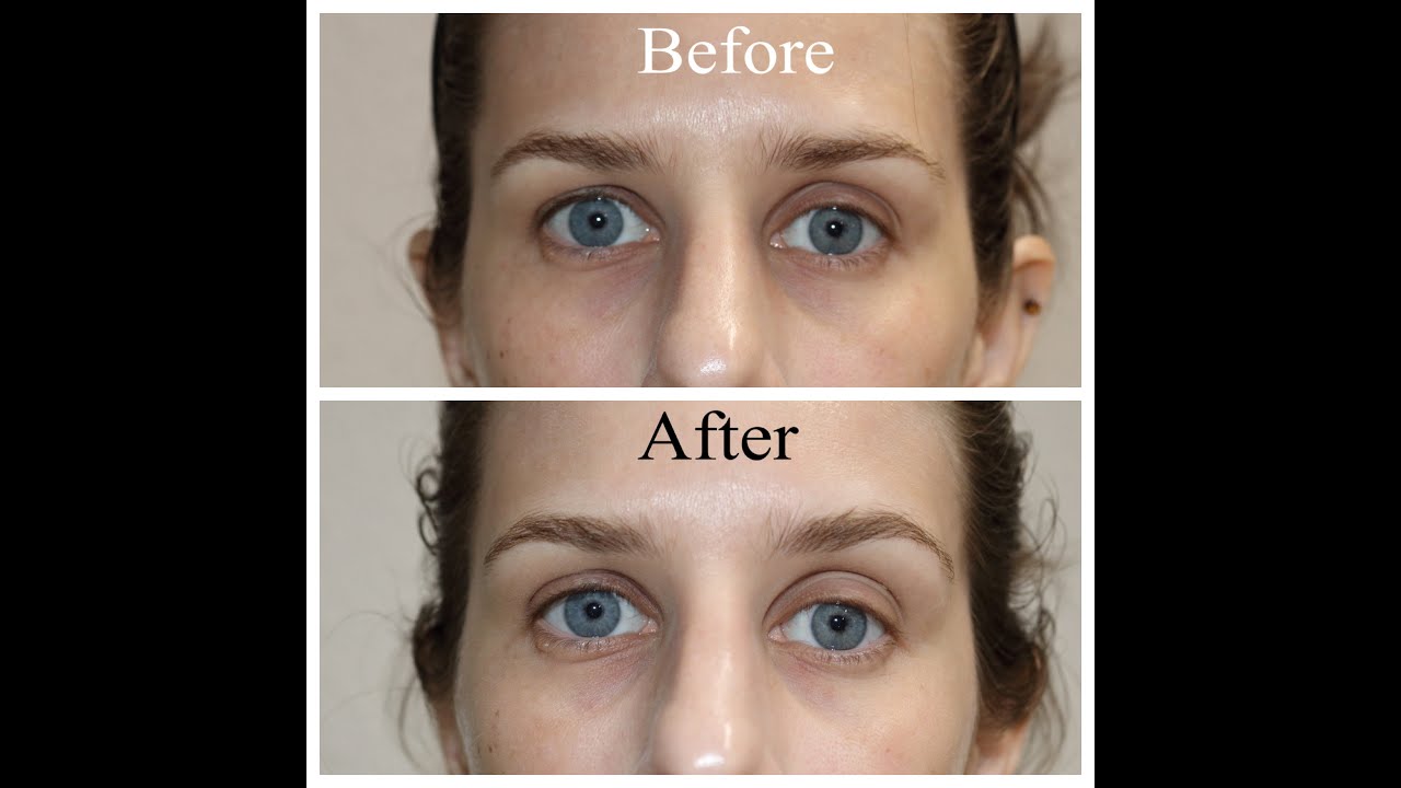 Bright and Tight by Science Serum 1st Impression