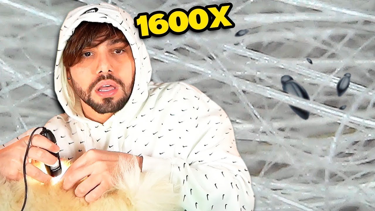 Comprei um microsc&oacute;pio s&oacute; pra ver o que tem no pelo do meu cachorro