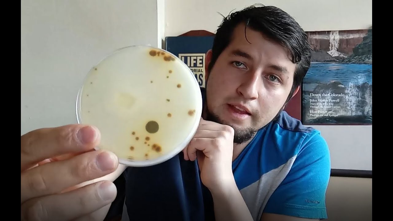 Cultivo casero desde Petri \\ Micelio contaminado en Petri