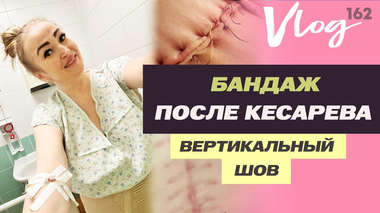 ЭКО. Как выбрать бандаж после кесарева сечения // Сняли швы
