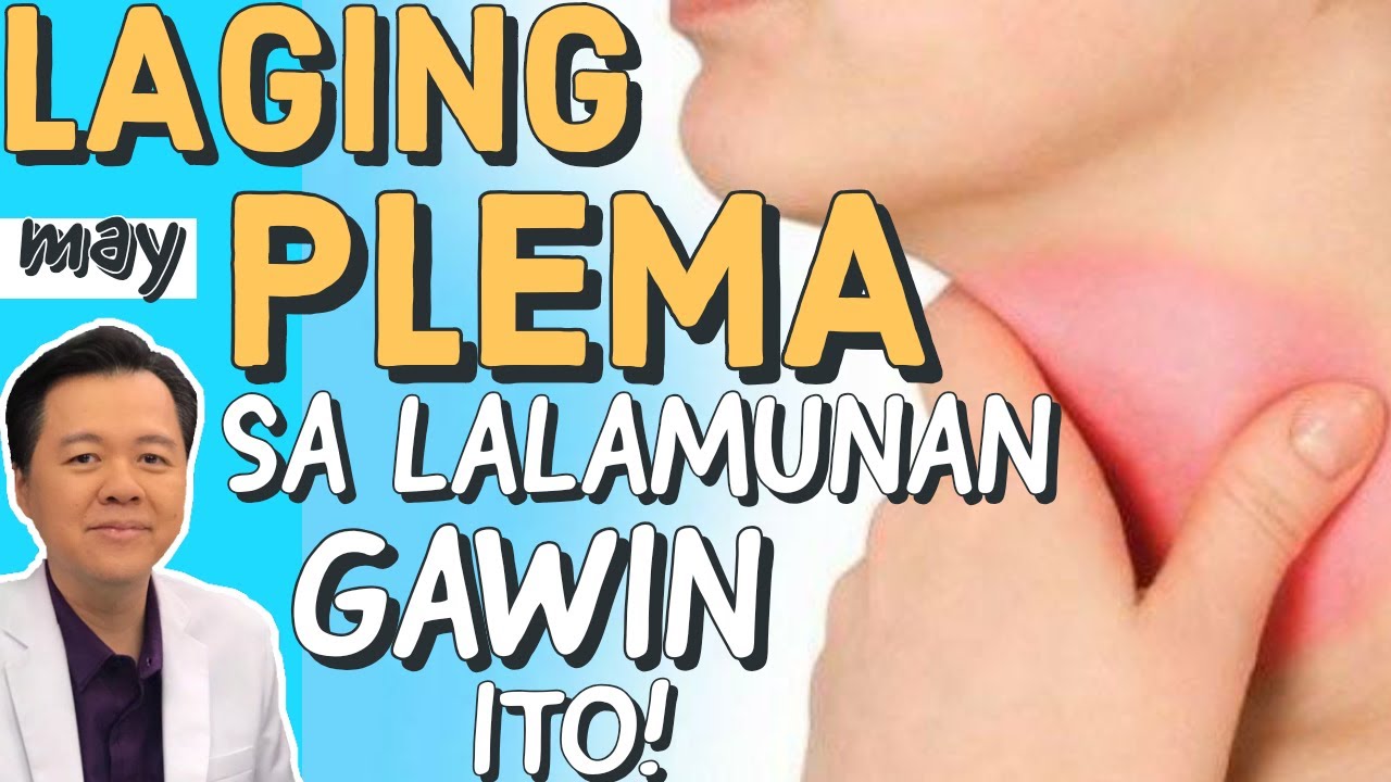 Laging May Plema sa Lalamunan: Gawin Ito! - By Doc Willie Ong
