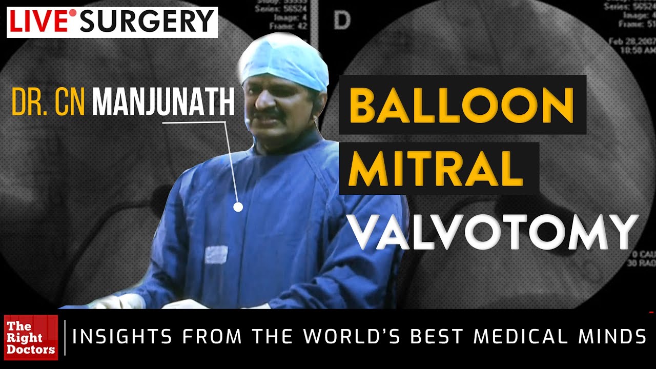 LIVE OT Balloon Mitral Valvotomy | Dr. CN Manjunath | CSI NIC Live Surgeries | TheRightDoctors