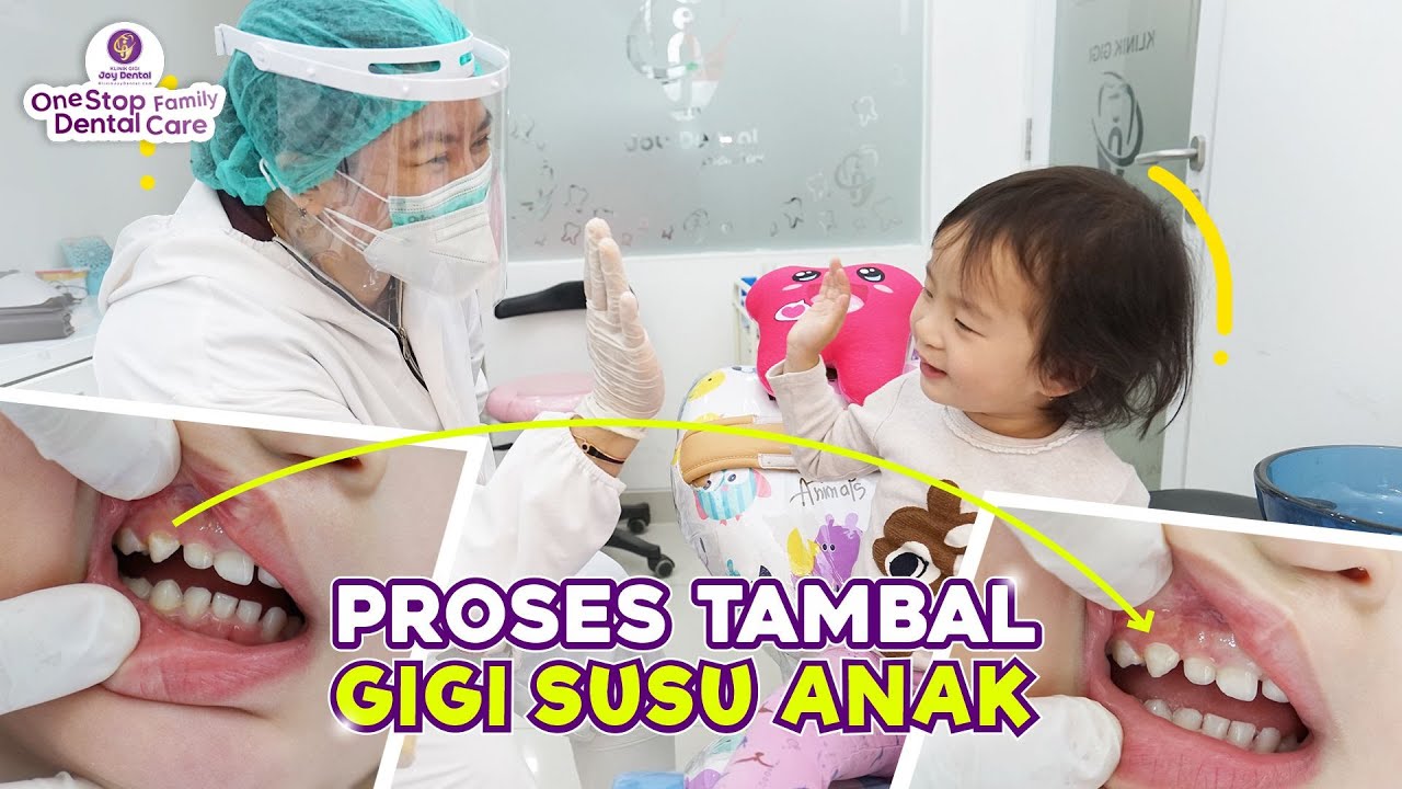 GIGI SUSU BERLUBANG APA PERLU DITAMBAL ?