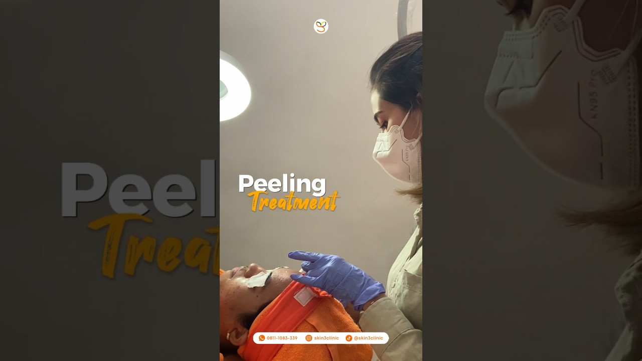 #peeling #treatments #laserndyag #laser #treatment #kulitsehat #kulit #specialskin #glowingskin