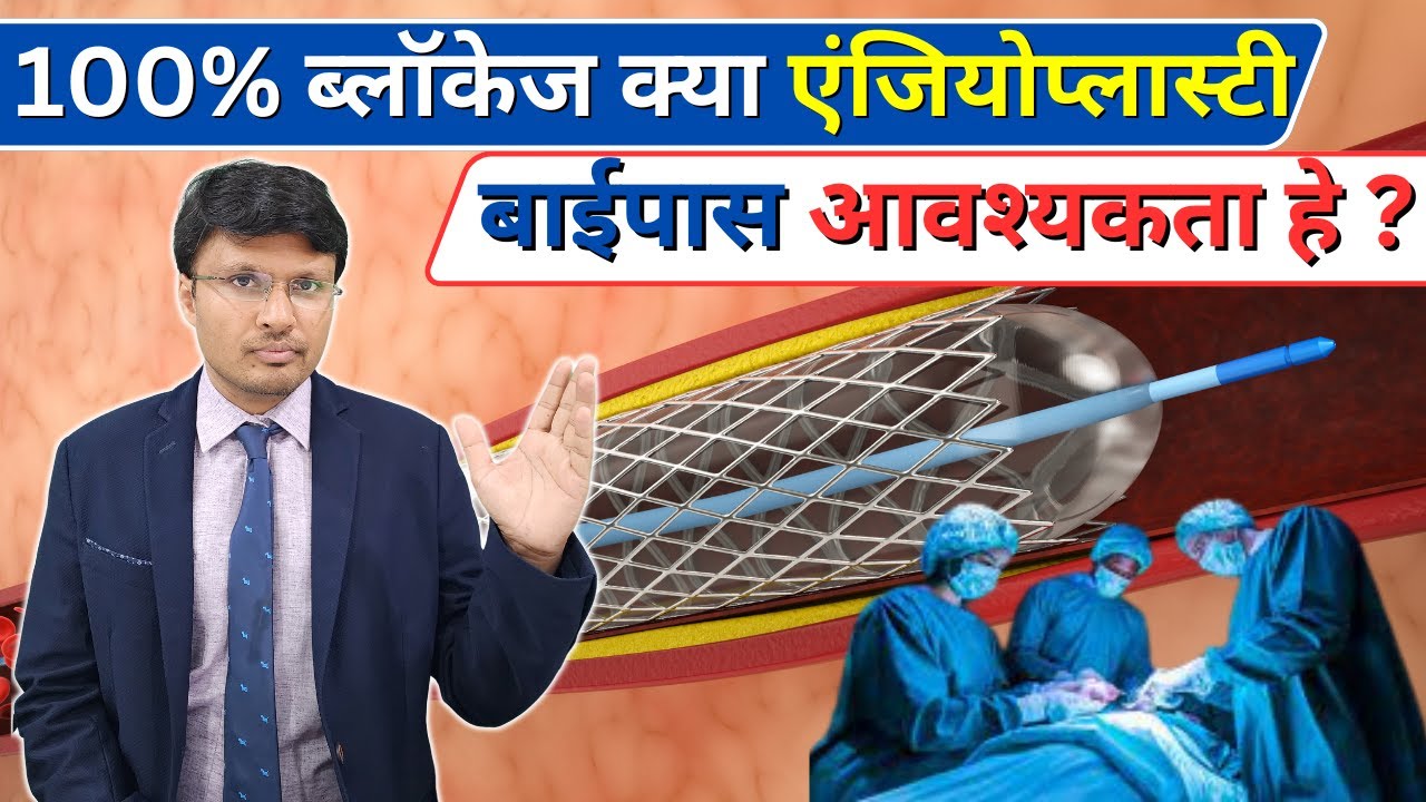 Do All Cases of 100% Blockage need angioplasty/bypass?
