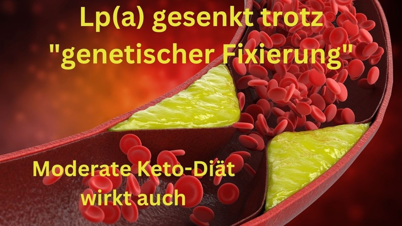 Selbstexperiment Teil 2: Moderate Keto-Diät wirkt auch - Lp(a) gesenkt trotz 