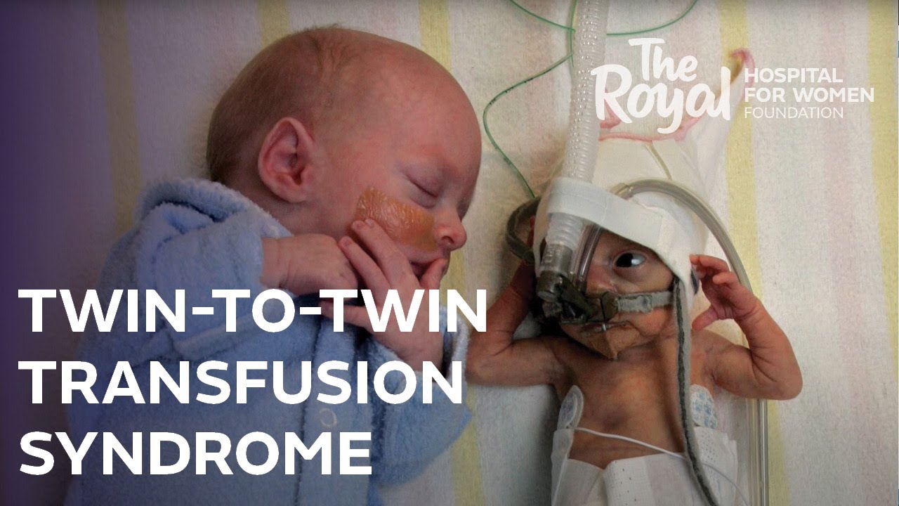 Twin-To-Twin Transfusion Syndrome (TTTS): Nicole's Story