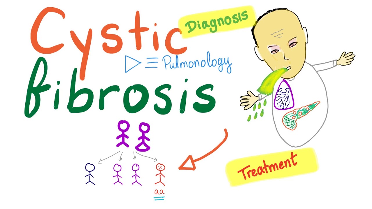 Cystic Fibrosis - Diagnosis & Treatment - Genetics