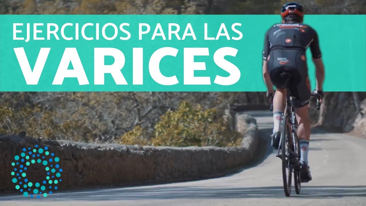 C&oacute;mo ELIMINAR LAS VARICES - Eliminar varices CON EJERCICIO