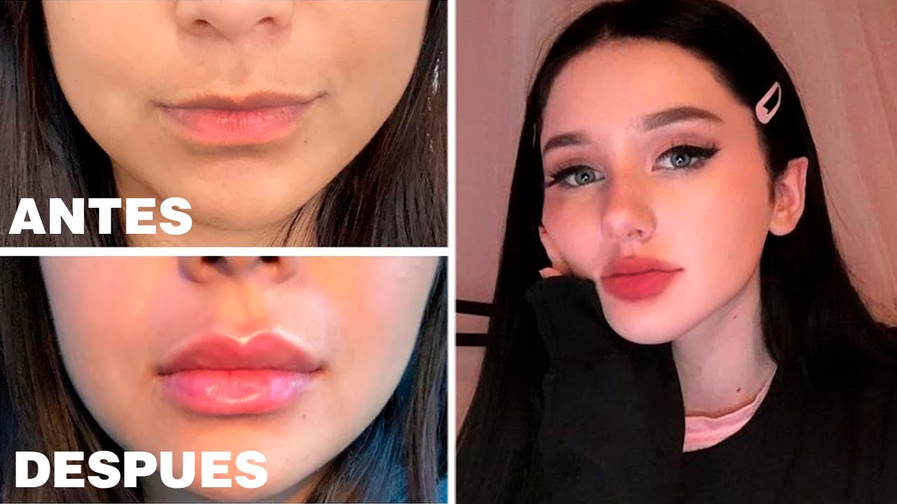 LABIOS Hermosos, Rosados y GRUESOS ( de forma NATURAL )
