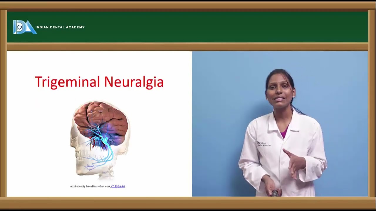 Facial palsy and trigeminal neuralgia | General Medicine for Dentists | #NEET#MDS#BDS#NBDE#ORE#DDS