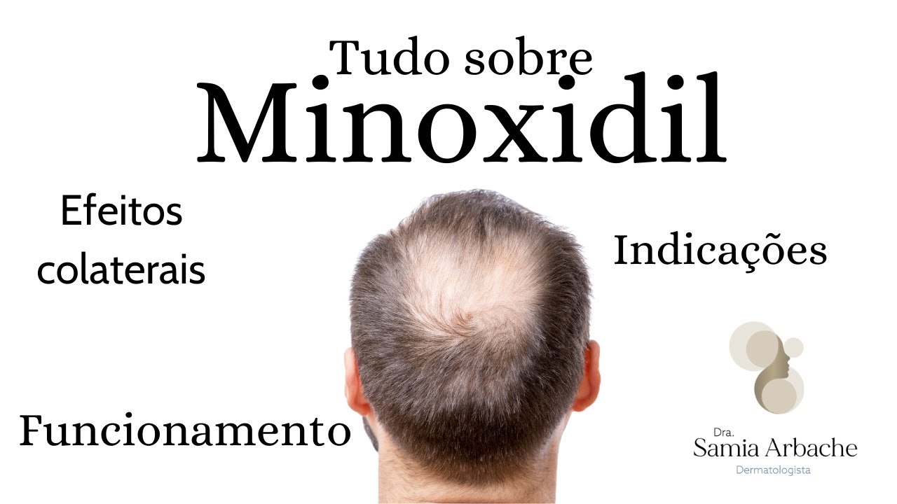 TUDO SOBRE MINOXIDIL T&Oacute;PICO
