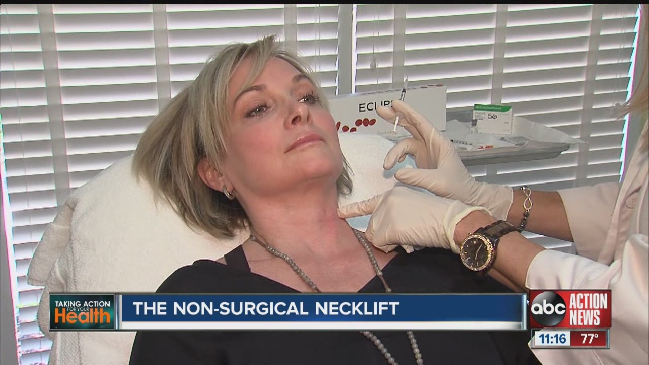 The non-surgical necklift