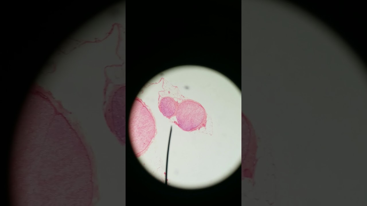 Cross-section peripheral nerve connective tissue histology