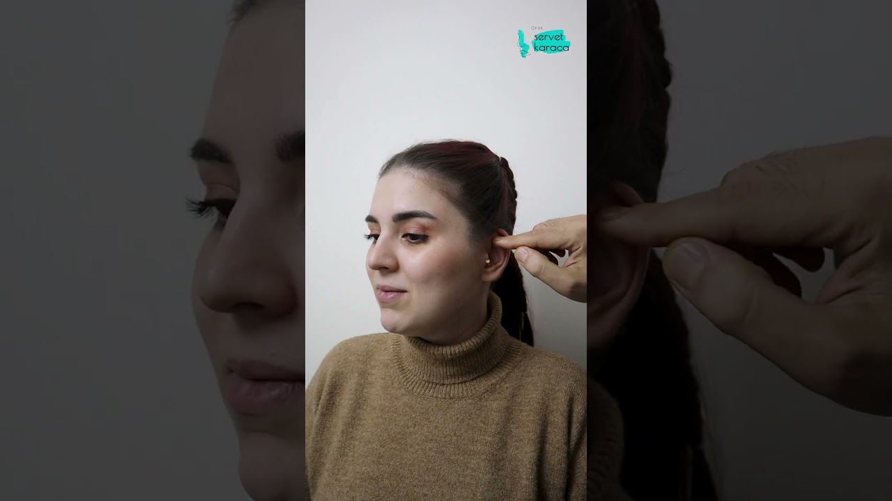 Kardeşlere &Ouml;zel: 3. Ay Kontrol&uuml; ve Yeni Otoplasti