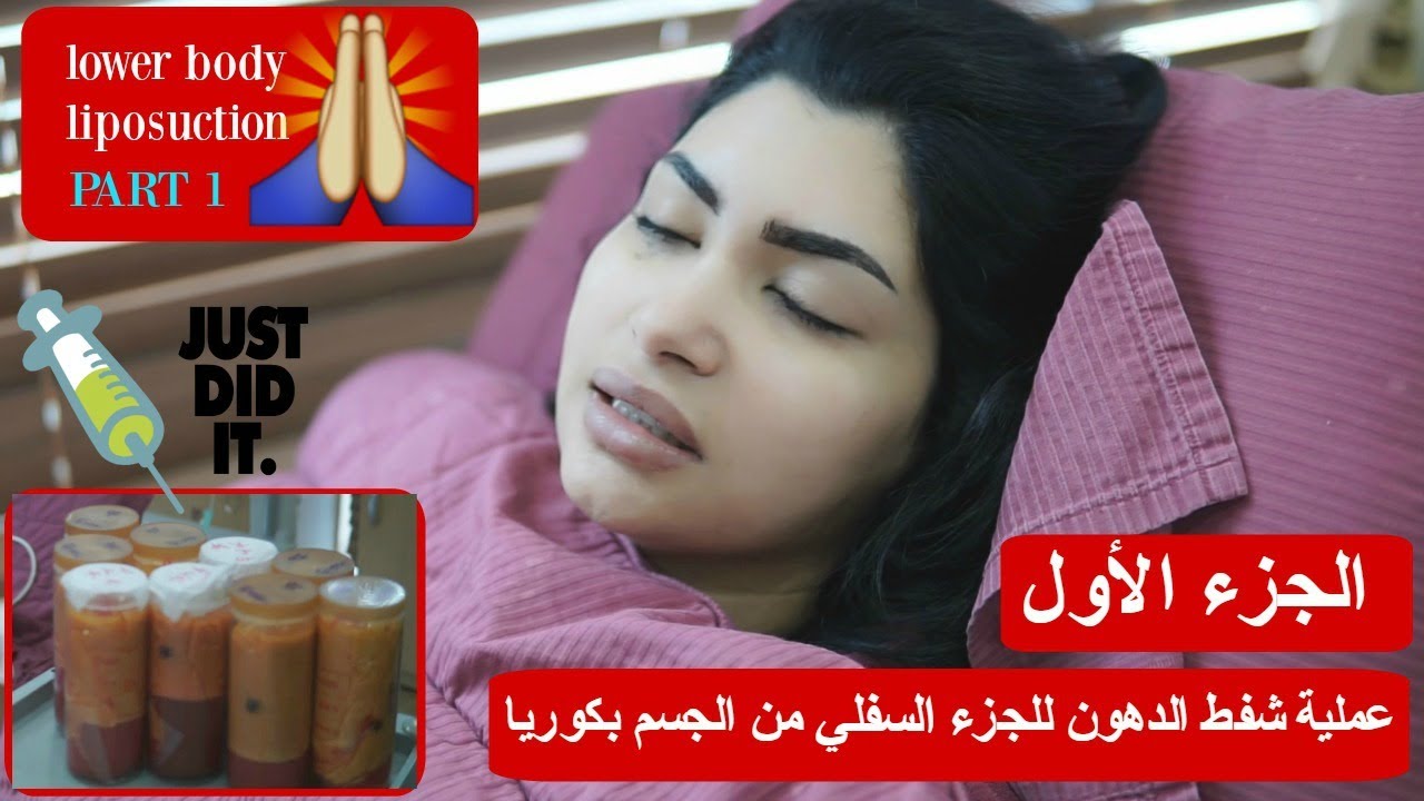 عملية شفط الدهون بكوريا الجزءالأول - Liposuction at 365mc hospital sponsored by Docfinderkorea