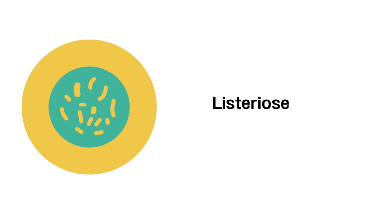 Listeriose - Infektionskrankheiten