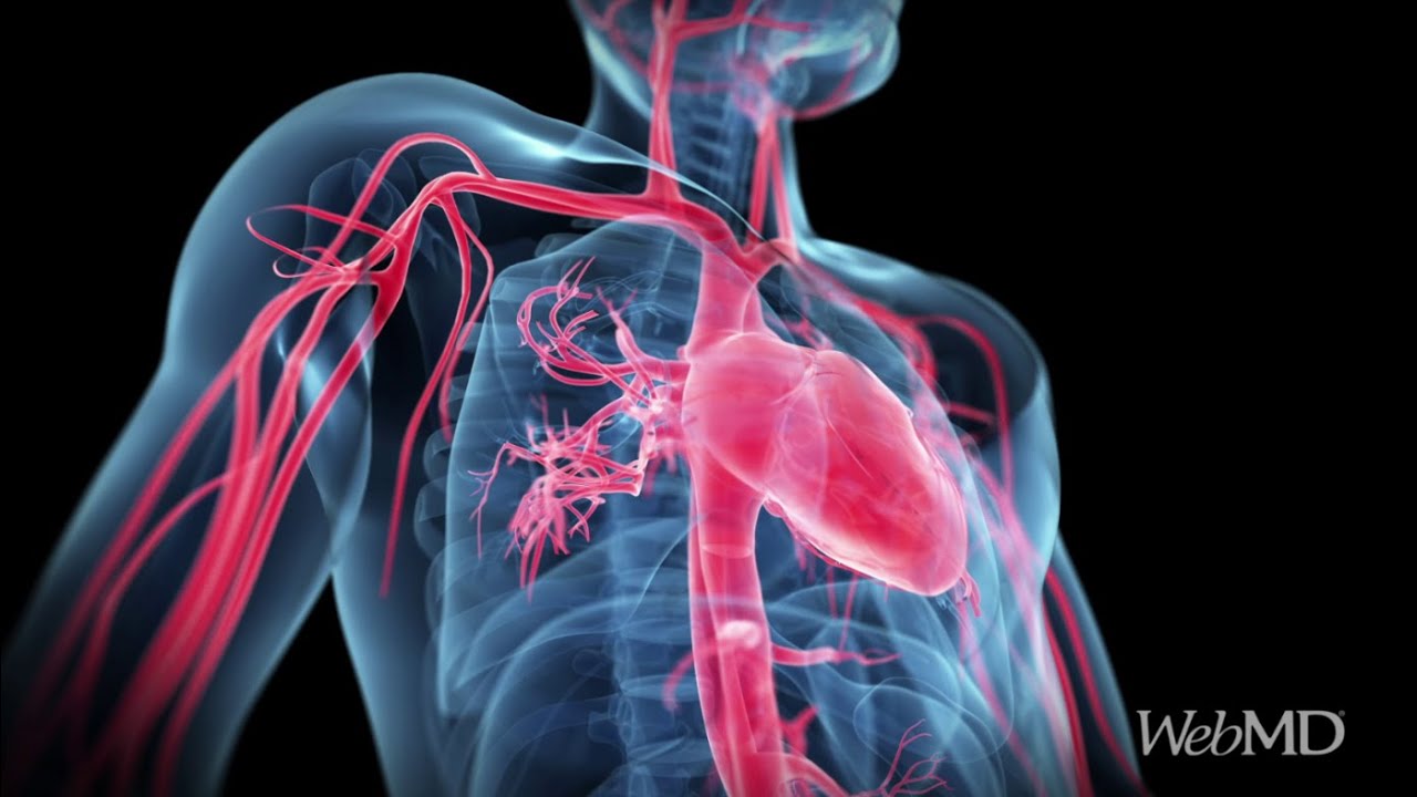 Hidden Sources of Trans Fat | WebMD